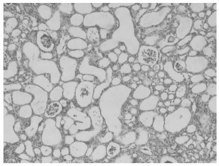 Serieintroduksjon til aktive folaturenheter: ① Avduking av virkningen av 5-metyltetrahydropteroic acid.
